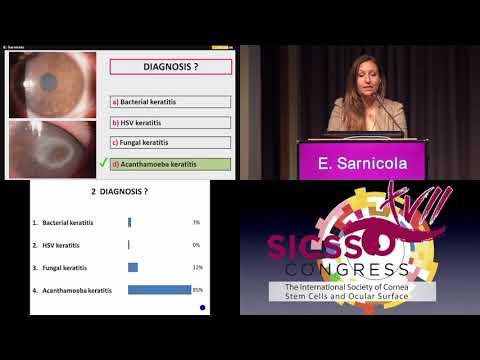SICSSO 2018 - ITA - E. Sarnicola (Turin) - Case presentation