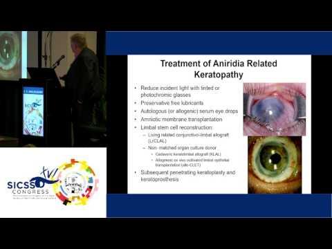 SICSSO 2017 - ENG - C. E. Willoughby (UK) - Developing a gene therapy for aniridia related keratopat