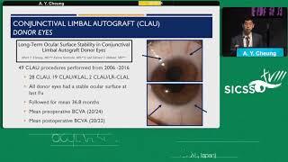 SICSSO 2019 - ITA - A. Y. Cheung - Long-term outcomes of ocular surface limbal stem cell transplanti