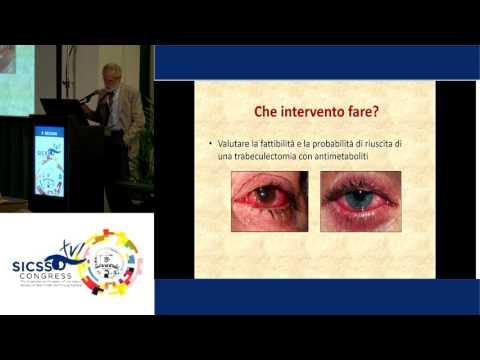 SICSSO 2017 - ENG - P. Brusini (Udine) - Which is the best surgical procedure to treat Glaucoma in O