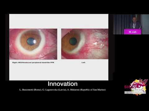 SICSSO 2018 - ITA - W. Lisch (Germany) - The corneal dystrophy Importer-phenotypic variation of the 