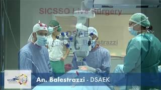 SICSSO 2017 - LIVE SURGERY - ITA - An. Balestrazzi (Grosseto) - DSAEK