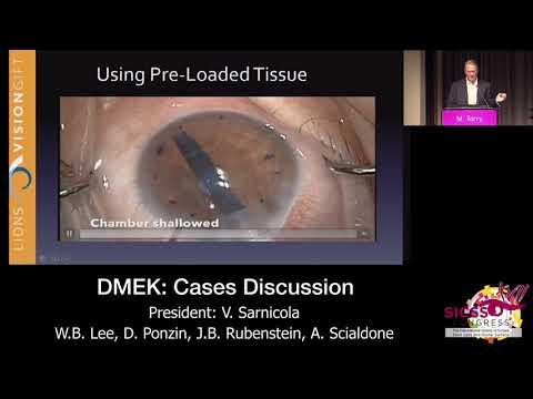 SICSSO 2018 - ENG - M. Terry (USA) - Pre-loaded DMEK: results and complications in the first 100 pat