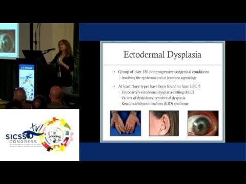 SICSSO 2017 - ENG - L. R. Sepsakos (USA) - Etiology and Classification of Severe Ocular Surface Dise