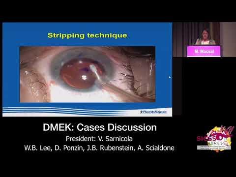 SICSSO 2018 - ENG - M. Macsai (USA) - Update on the use of Rho Kinase inhibitors after Descemets Str