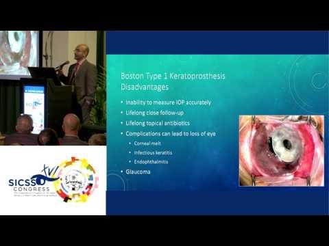 SICSSO 2017 - ENG - M. Darvish-Zargar (Canada) - Keratoprosthesis vs. Ocular Surface Transplantation