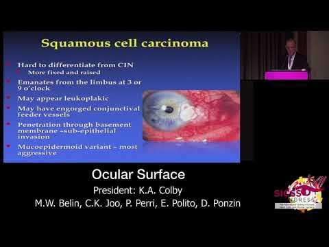 SICSSO 2018 - ENG - J. B. Rubenstein (USA) - Ocular surface tumors: a practical prospective